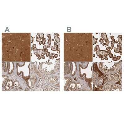 <b>Independent Antibodies Validation. </b>Immunohistochemistry-Paraffin: CAMSAP1L1 Antibody [NBP1-82935] - Staining of human cerebral cortex, placenta, prostate and testis using Anti-CAMSAP2 antibody NBP1-82935 (A) shows similar protein distribution across tissues to independent antibody NBP1-82934 (B).