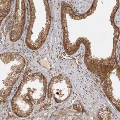 Immunohistochemistry-Paraffin: CAMSAP1L1 Antibody [NBP1-82935] - Staining of human prostate shows moderate cytoplasmic positivity in glandular cells.