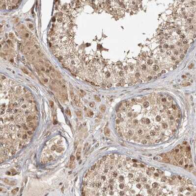 Immunohistochemistry-Paraffin: CAMSAP1L1 Antibody [NBP1-82935] - Staining of human testis shows moderate cytoplasmic positivity in Leydig cells.