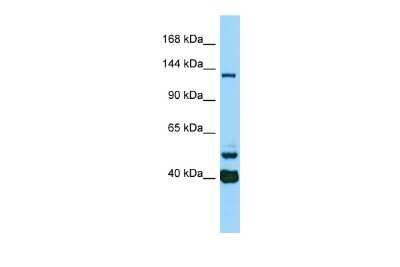 Western Blot CAMSAP3 Antibody - BSA Free