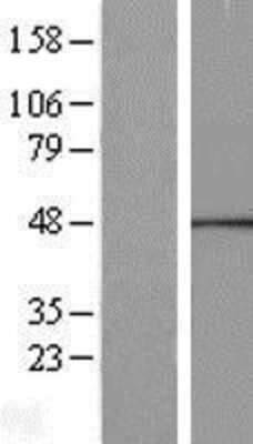 Western Blot: Calcium Activated Nucleotidase 1/CANT1 Overexpression Lysate [NBP2-10196] - Left-Empty vector transfected control cell lysate (HEK293 cell lysate); Right -Over-expression Lysate for CANT1.