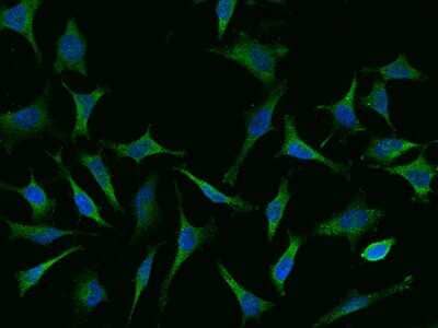 Immunocytochemistry/Immunofluorescence: CAP1 Antibody [NBP2-99569] - Immunofluorescence staining of CAP1 in Hela cells. Cells were fixed with 4% PFA, blocked with 10% serum, and incubated with rabbit anti-human CAP1 polyclonal antibody (dilution ratio 1:1000) at 4C overnight. Then cells were stained with the Alexa Fluor(R)488-conjugated Goat Anti-rabbit IgG secondary antibody (green) and counterstained with DAPI (blue).Positive staining was localized to Cytoplasm.