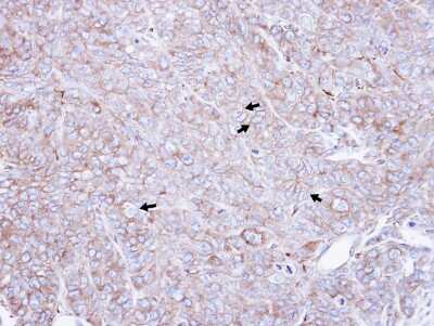 Immunohistochemistry-Paraffin: CAP1 Antibody [NBP1-31718] - DLD1 xenograft , using CAP1 antibody at 1:500 dilution. Antigen Retrieval: Citrate buffer, pH 6.0, 15 min. 