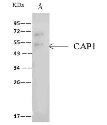 Immunoprecipitation: CAP1 Antibody [NBP2-99569] - CAP1 was immunoprecipitated using: Lane A: 0.5 mg 293T Whole Cell Lysate 4 ul anti-CAP1 rabbit polyclonal antibody and 60 ug of Immunomagnetic beads Protein A/G.  Primary antibody: Anti-CAP1 rabbit polyclonal antibody, at 1:100 dilution. Secondary antibody: Clean-Blot IP Detection Reagent (HRP) at 1:1000dilution. Developed using the ECL technique. Performed under reducing conditions. Predicted band size: 52 kDa. Observed band size: 50 kDa.