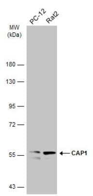 Western Blot: CAP1 Antibody [NBP1-31718] - Various whole cell extracts (30 ug) were separated by 7.5% SDS-PAGE, and the membrane was blotted with CAP1 antibody [C1C3] diluted at 1:3000. The HRP-conjugated anti-rabbit IgG antibody was used to detect the primary antibody.