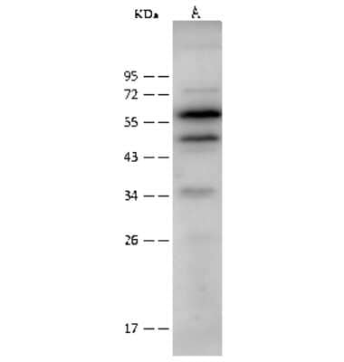 Western Blot: CAP1 Antibody [NBP2-99569] - Anti-CAP1 rabbit polyclonal antibody at 1:500 dilution. Lane A: HeLa Whole Cell Lysate Lysates/proteins at 30 ug per lane. Secondary Goat Anti-Rabbit IgG (H+L)/HRP at 1/10000 dilution. Developed using the ECL technique. Performed under reducing conditions. Predicted band size: 52 kDa