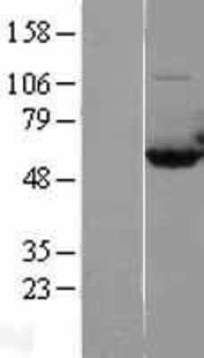 Western Blot: CAP1 Overexpression Lysate (Adult Normal) [NBL1-08674] Left-Empty vector transfected control cell lysate (HEK293 cell lysate); Right -Over-expression Lysate for CAP1.