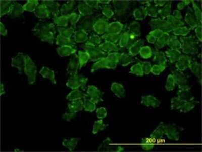 Immunocytochemistry/Immunofluorescence: CAP2 Antibody (3G9-1A5) [H00010486-M01] - Analysis of monoclonal antibody to CAP2 on HeLa cell. Antibody concentration 10 ug/ml.