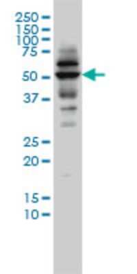 Western Blot: CAP2 Antibody (3G9-1A5) [H00010486-M01] - CAP2 monoclonal antibody (M01), clone 3G9-1A5 Analysis of CAP2 expression in C32.