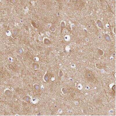 Immunohistochemistry: CAP2 Antibody [NBP2-30561] - Staining of human hippocampus shows moderate cytoplasmic positivity in neuronal cells.