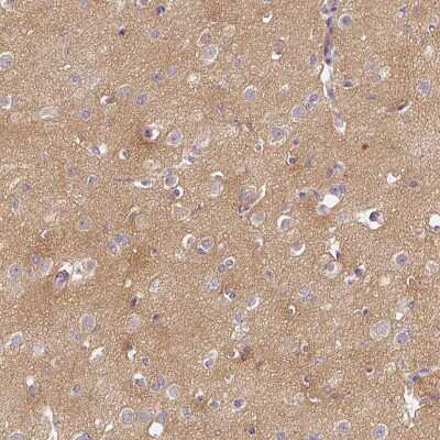 Immunohistochemistry-Paraffin: CAP2 Antibody [NBP2-30561] - Staining of human cerebral cortex shows high expression.