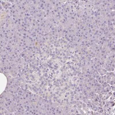 Immunohistochemistry-Paraffin: CAP2 Antibody [NBP2-30561] - Staining of human pancreas shows low expression as expected.