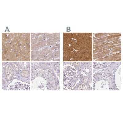 <b>Independent Antibodies Validation. </b>Immunohistochemistry-Paraffin: CAP2 Antibody [NBP2-30561] - Staining of human cerebral cortex, heart muscle, kidney and testis using Anti-CAP2 antibody NBP2-30561 (A) shows similar protein distribution across tissues to independent antibody NBP2-30572 (B).