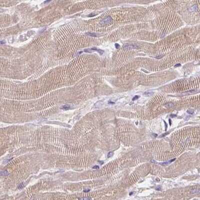 Immunohistochemistry-Paraffin: CAP2 Antibody [NBP2-30561] - Staining of human heart muscle.