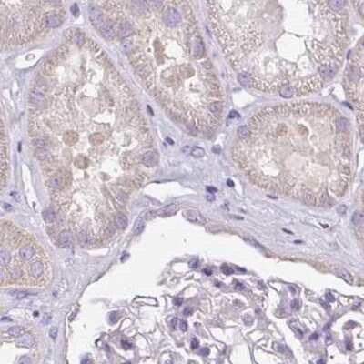 Immunohistochemistry-Paraffin: CAP2 Antibody [NBP2-30561] - Staining of human kidney.