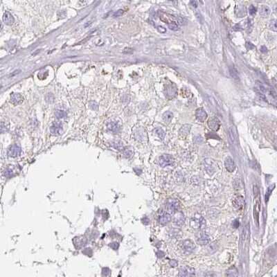 Immunohistochemistry-Paraffin: CAP2 Antibody [NBP2-30561] - Staining of human testis.