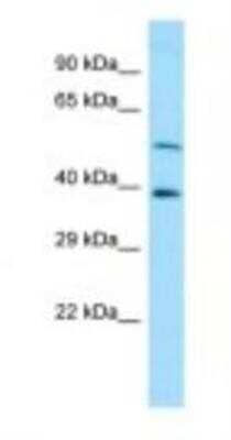 Western Blot: CAP2 Antibody [NBP1-98541] - 721_B Cell Lysate 1.0ug/ml, Gel Concentration: 12%