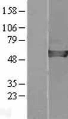 Western Blot: CAP2 Overexpression Lysate (Adult Normal) [NBL1-08675] Left-Empty vector transfected control cell lysate (HEK293 cell lysate); Right -Over-expression Lysate for CAP2.