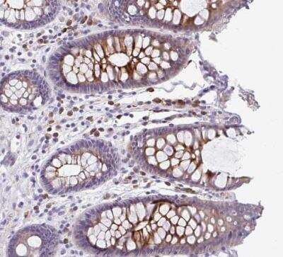 Immunohistochemistry-Paraffin: CAPC / LRRC26 Antibody [NBP2-30877] - Staining of human colon shows strong cytoplasmic positivity in glandular cells.