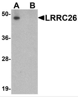 Western Blot: CAPC / LRRC26 Antibody [NBP2-81900] - Analysis of CAPC / LRRC26 in human prostate tissue lysate with CAPC / LRRC26 antibody at 0.5 ug/ml in (A) the absence and (B) presence of blocking peptide.