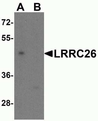Western Blot: CAPC / LRRC26 Antibody [NBP2-81900] - Analysis of CAPC / LRRC26 in Jurkat cell lysate with CAPC / LRRC26 antibody at 0.5 ug/ml in (A) the absence and (B) presence of blocking peptide.