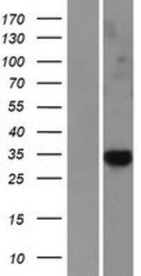 Western Blot CAPC / LRRC26 Overexpression Lysate