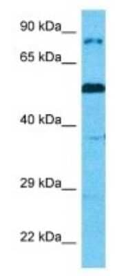 Western Blot CAPN14 Antibody