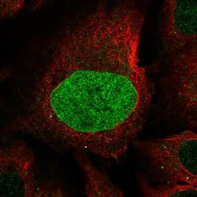 Immunocytochemistry/Immunofluorescence: CAPN8 Antibody [NBP2-56622] - Staining of human cell line U-2 OS shows localization to nucleoplasm, nuclear membrane & vesicles.