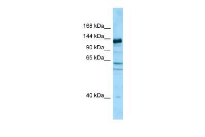 Western Blot: CAPRIN2 Antibody [NBP2-82980] - WB Suggested Anti-CAPRIN2 Antibody. Titration: 1.0 ug/ml. Positive Control: Fetal Brain