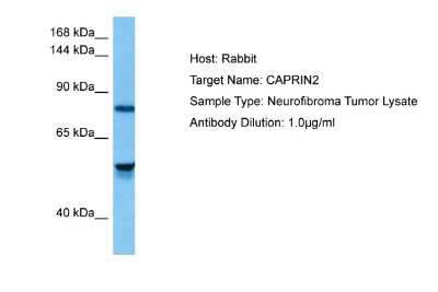Western Blot: CAPRIN2 Antibody [NBP2-82988] - Host: Rabbit. Target Name: CAPRIN2. Sample Tissue: Human Neurofibroma Tumor lysates. Antibody Dilution: 1ug/ml