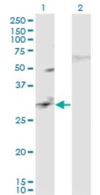 Western Blot CAPS2 Antibody (3C6)