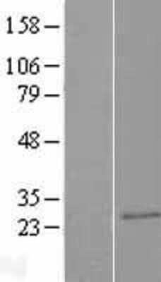 Western Blot: CAPSL Overexpression Lysate (Adult Normal) [NBP2-08390] Left-Empty vector transfected control cell lysate (HEK293 cell lysate); Right -Over-expression Lysate for CAPSL.