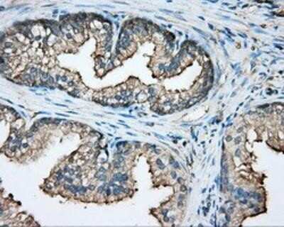 Immunohistochemistry-Paraffin: CAPZA1 Antibody (OTI2G4) [NBP2-02500] - Staining of paraffin-embedded prostate tissue using anti-CAPZA1 mouse monoclonal antibody.