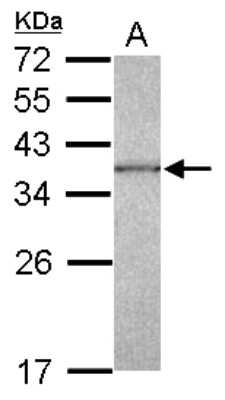 Western Blot: CAPZA1 Antibody [NBP2-15692] - Sample (30 ug of whole cell lysate) A: Jurkat 12% SDS PAGE gel, diluted at 1:1000.