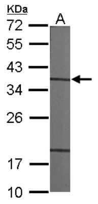 Western Blot CAPZA1 Antibody