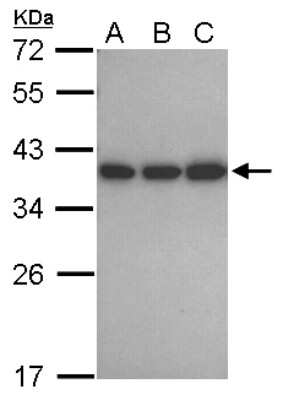 Western Blot: CAPZA1 Antibody [NBP2-15693] - Sample (30 ug of whole cell lysate) A: 293T B: A431 C: Jurkat 12% SDS PAGE gel, diluted at 1:1000.