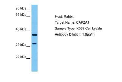 Western Blot: CAPZA1 Antibody [NBP2-88776] - Host: Rabbit. Target Name: CAPZA1. Sample Tissue: Human K562 Whole Cell lysates. Antibody Dilution: 1ug/ml