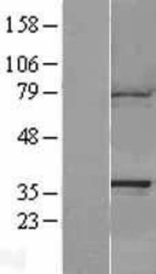 Western Blot CAPZA1 Overexpression Lysate