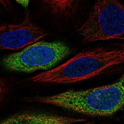 Immunocytochemistry/Immunofluorescence: CAPZA2 Antibody [NBP2-58907] - Staining of human cell line SiHa shows localization to endoplasmic reticulum.