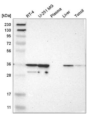 Western Blot: CAPZA2 Antibody [NBP2-58907] - Western blot analysis in human cell line RT-4, human cell line U-251 MG, human plasma, human liver tissue and human tonsil tissue.