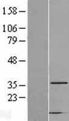 Western Blot: CAPZA2 Overexpression Lysate (Adult Normal) [NBL1-08691] Left-Empty vector transfected control cell lysate (HEK293 cell lysate); Right -Over-expression Lysate for CAPZA2.