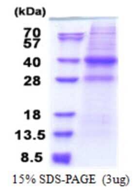 SDS-Page: CAPZA2 Protein [NBP2-22730]