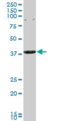 Western Blot: CAPZA3 Antibody (4D6) [H00093661-M01] - CAPZA3 monoclonal antibody (M01), clone 4D6. Analysis of CAPZA3 expression in PC-12.