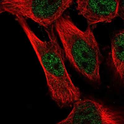 Immunocytochemistry/Immunofluorescence: CAPZB Antibody [NBP2-54936] - Staining of human cell line U-251 MG shows localization to nucleoplasm.