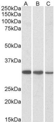 Western Blot: CAPZB Antibody [NB100-814] - Analysis of of Jurkat (A), HeLa (B) and NIH-3T3 (C) lysates (35ug protein in RIPA buffer).