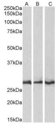 Western Blot: CAPZB Antibody [NB100-814] - Analysis of Mouse (A), Rat (B) and Pig (C) Heart lysates (35ug protein in RIPA buffer). 