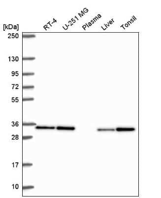 Western Blot: CAPZB Antibody [NBP2-54936] - Western blot analysis in human cell line RT-4, human cell line U-251 MG, human plasma, human liver tissue and human tonsil tissue.