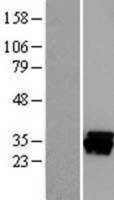 Western Blot: CAPZB Overexpression Lysate (Adult Normal) [NBL1-08693] Left-Empty vector transfected control cell lysate (HEK293 cell lysate); Right -Over-expression Lysate for CAPZB.