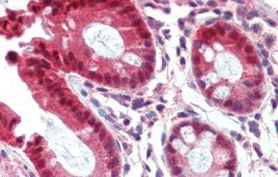 Immunohistochemistry-Paraffin: CAR/NR1I3 Antibody [NBP1-54935] - Human Colon Tissue, antibody concentration 5 ug/ml.