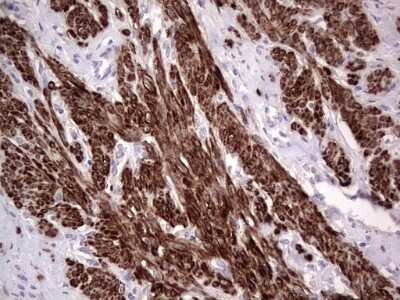 Immunohistochemistry: CAR/NR1I3 Antibody (OTI1C6) - Azide and BSA Free [NBP2-71525] - Analysis of Human endometrium tissue. (Heat-induced epitope retrieval by 1 mM EDTA in 10mM Tris, pH8.5, 120C for 3min)